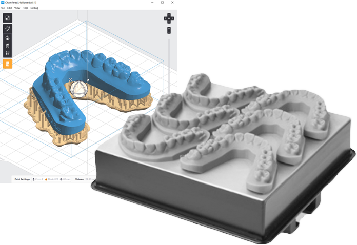 digital dental lab