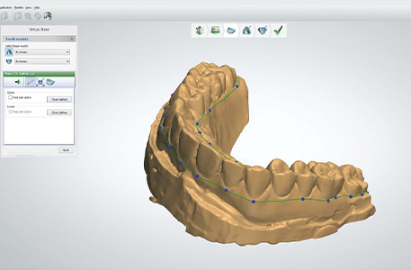 digital services dental lab