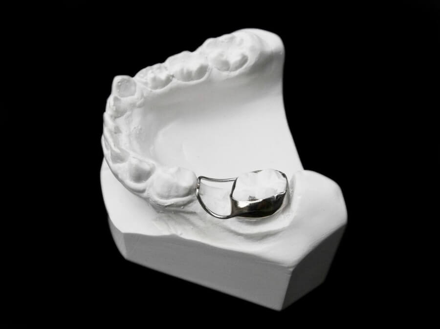 Orthodontic Appliances for Space Maintenance ☑️ CD Ortho Studio