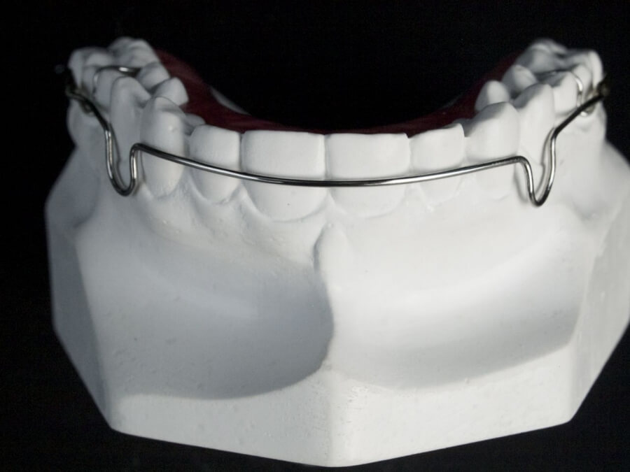 Orthodontic Appliances for Retention ☑️ CD Ortho Studio