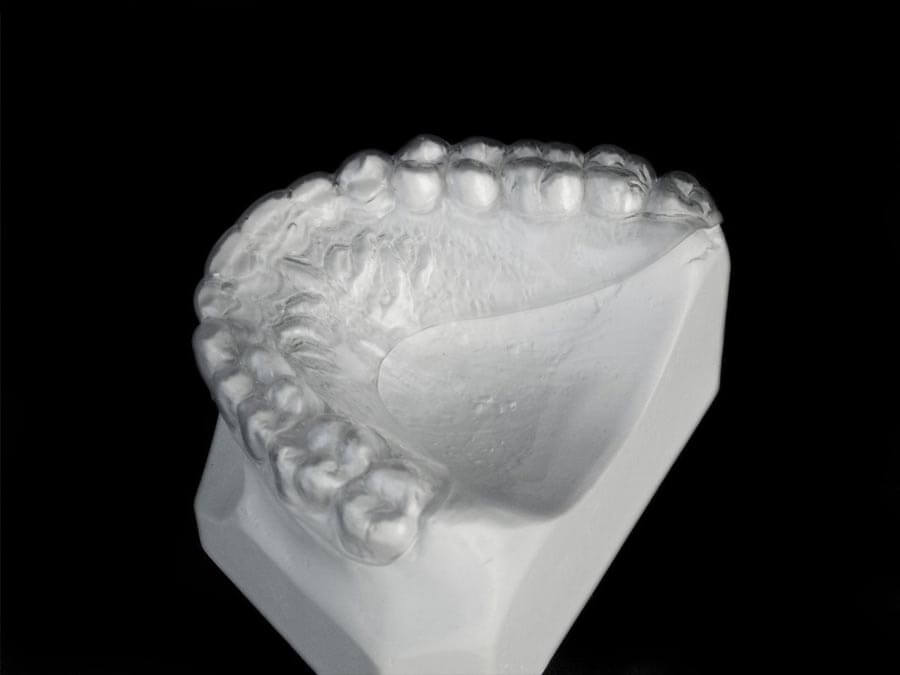 Orthodontic Appliances for Retention ☑️ CD Ortho Studio