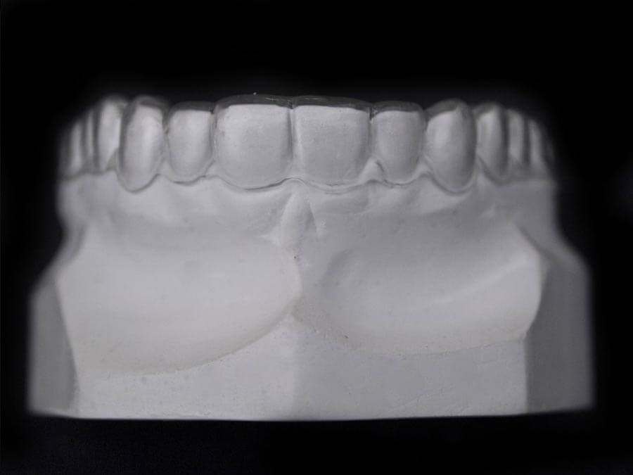 Orthodontic Appliances for Retention ☑️ CD Ortho Studio