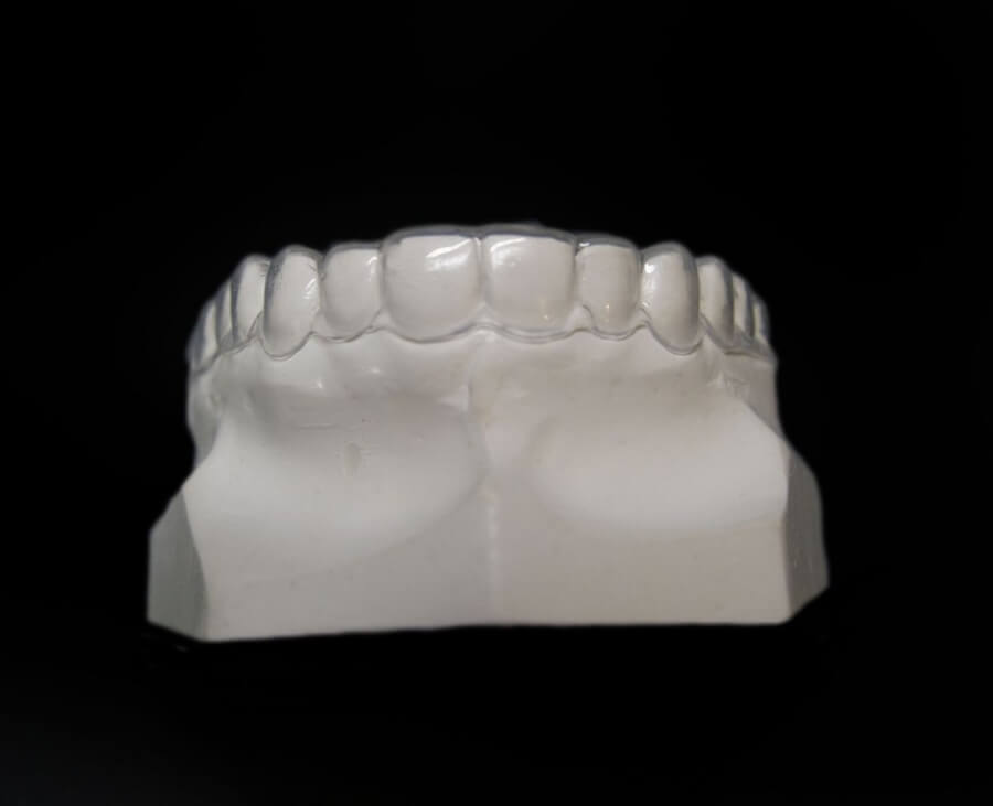 Orthodontic Appliances for Retention ☑️ CD Ortho Studio