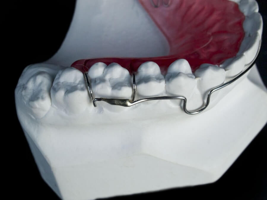 Orthodontic Appliances for Retention ☑️ CD Ortho Studio