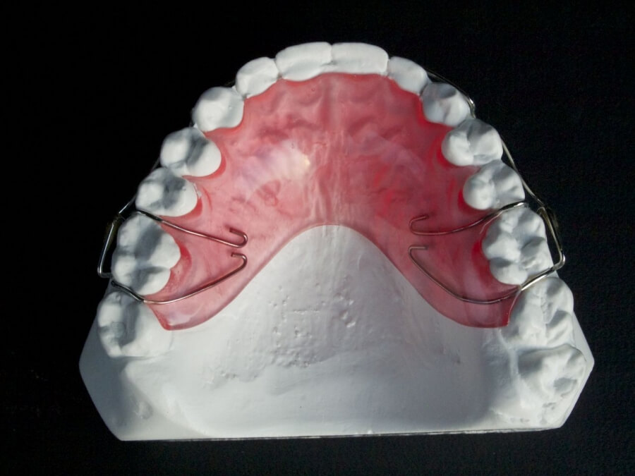 Orthodontic Appliances for Retention ☑️ CD Ortho Studio