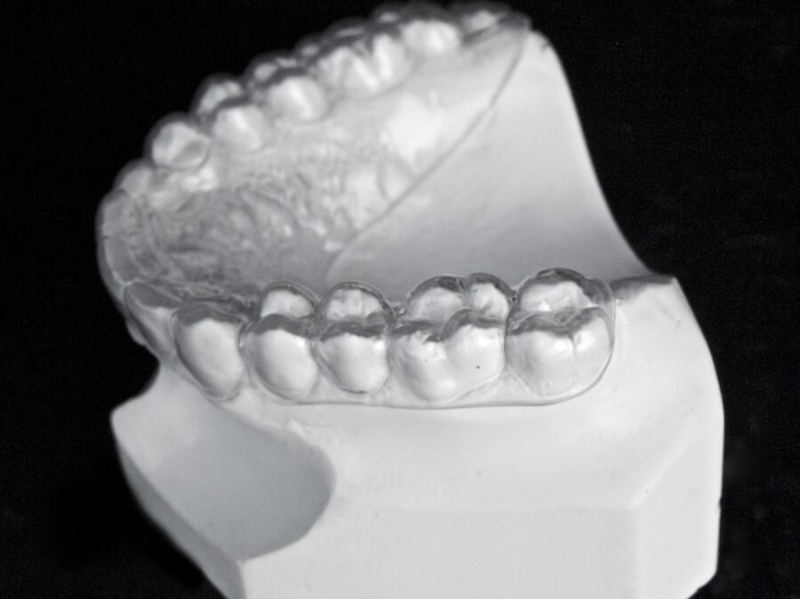 Orthodontic Appliances for Retention ☑️ CD Ortho Studio