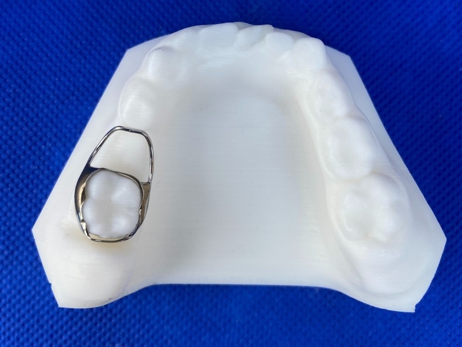 Orthodontic Appliances for Space Maintenance ☑️ CD Ortho Studio