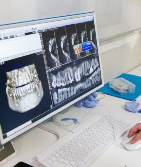 Image depicts a computer with a digital scan of a patient's teeth.