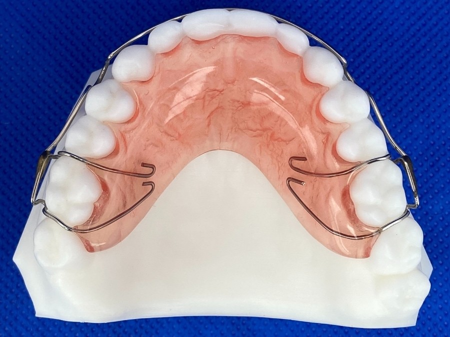 Orthodontic Appliances for Alignment ☑️ CD Ortho Studio