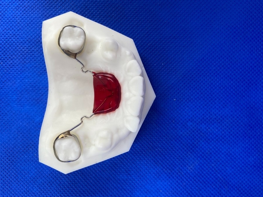 Orthodontic Appliances for Space Maintenance ☑️ CD Ortho Studio