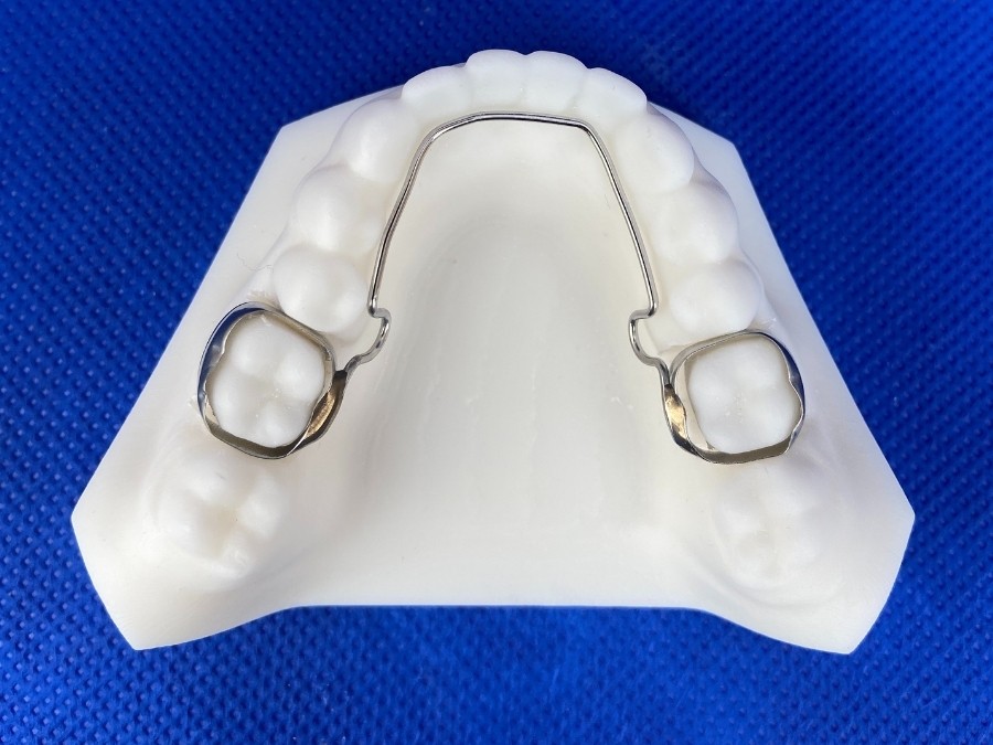 Hyrax Appliance ☑️ CD Ortho Studio Orthodontic Devices