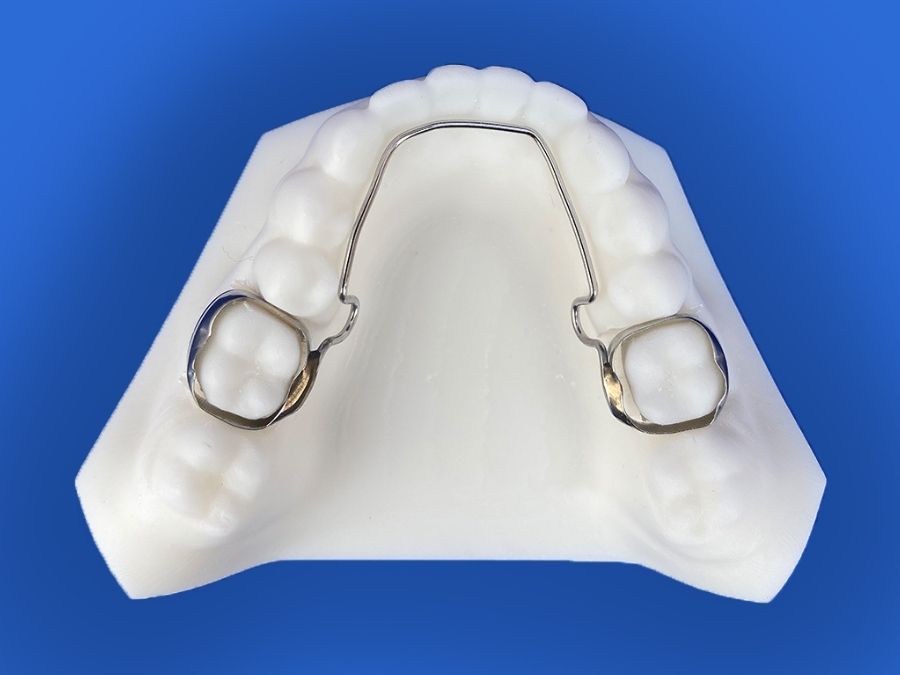 Orthodontic Appliances for Space Maintenance 2