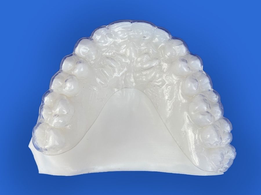 retention orthodontic appliance essix 1