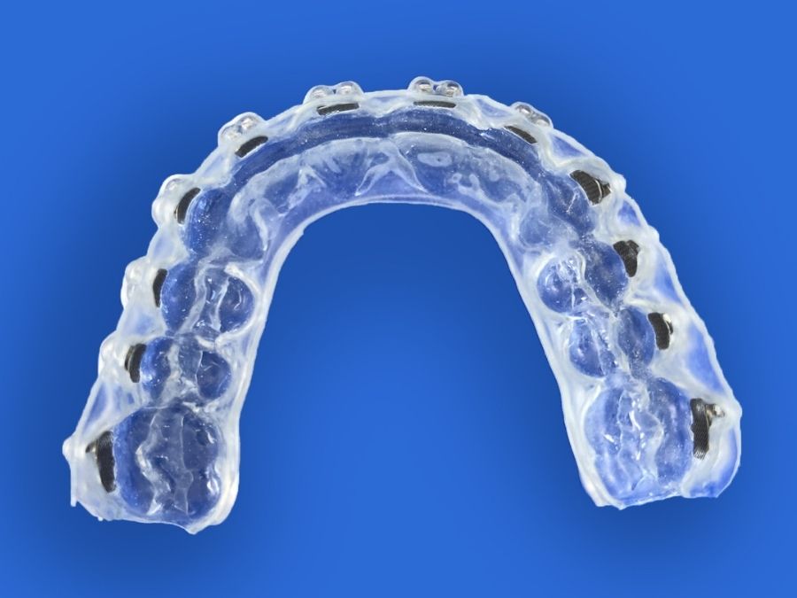 common alignment orthodontic appliance