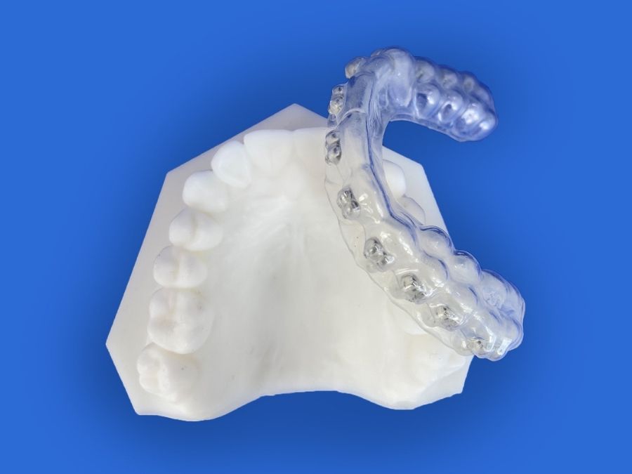 orthodontic appliance for teeth alignment